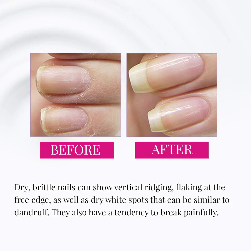 Nail Tek Foundation 3 Ridge Filler For Hard, Brittle Nails (15ml/0.5oz) - Image 4